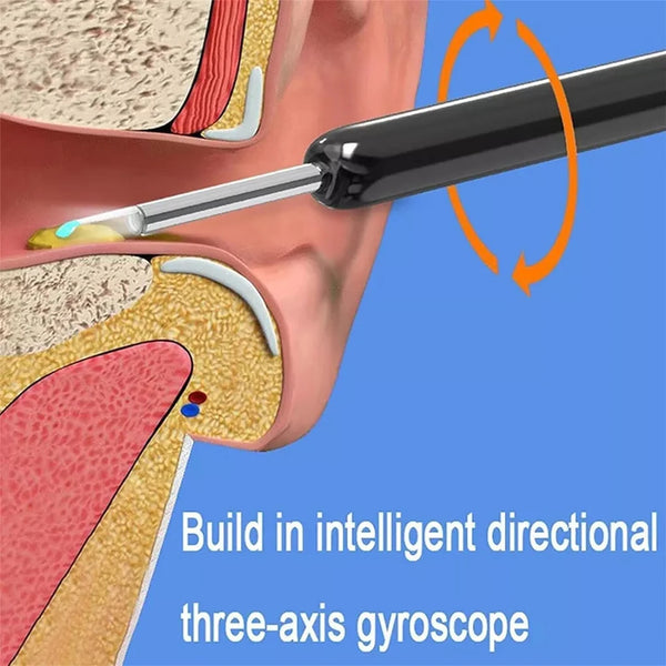 Smart Ear Cleaner with Camera